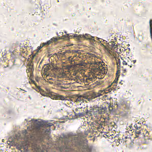 Ascaris_egg_fert5_embryo_200x.jpg