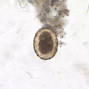 Ascaris_egg_fert_200x.jpg