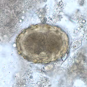 Ascaris_egg_fert_embryo.jpg