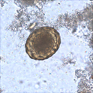 Ascaris_fertile_BAM1.jpg