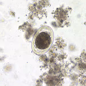 Ascaris_egg_fert2_decort_200x.jpg