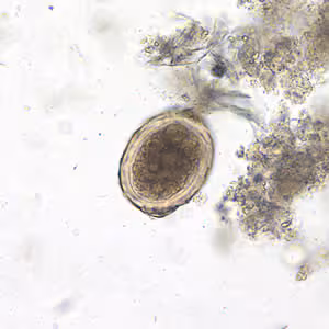 Ascaris_egg_fert3_decort_200x.jpg