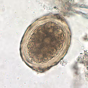 Ascaris_egg_fert4_decort_400x.jpg