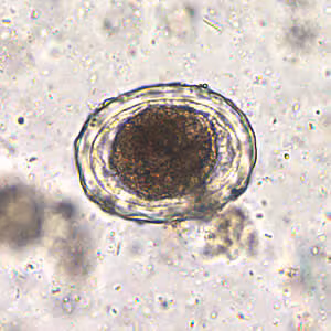 Ascaris_egg_fert_decort_200x.jpg