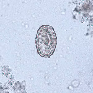 Ascaris_egg_larva2.jpg