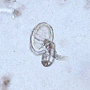 Ascaris_egg_larva3.jpg