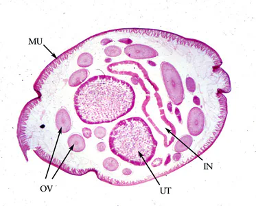 Ascaris_female_cross_section.jpg
