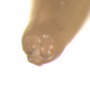Ascaris_mouthparts_OrangeCounty.jpg