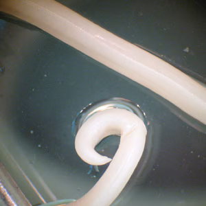 Ascaris_posterior_BAM.jpg