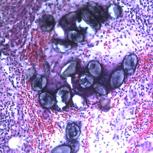 Ascaris_eggs_tissue_200x_BAM1.jpg