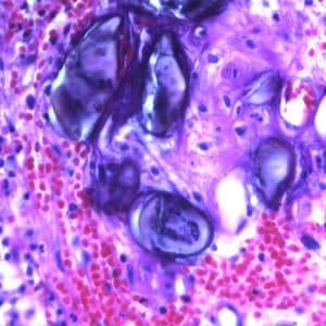 Ascaris_eggs_tissue_400x_BAM1.jpg