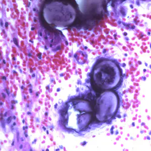 Ascaris_eggs_tissue_400x_BAM2.jpg
