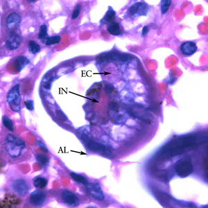 Ascaris_larvae_tissue_1000x_BAM1.jpg