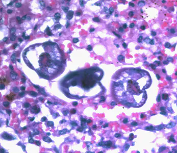 Ascaris_larvae_tissue_400x_BAM1.jpg