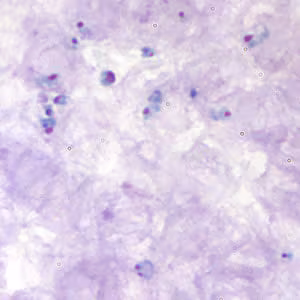Babesia_thick_giemsa.jpg