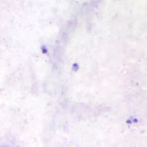 Babesia_thick_giemsa2.jpg