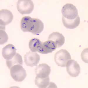 Babesia_thin_giemsa.jpg