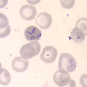 Babesia_thin_giemsa2.jpg