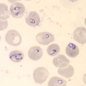 Babesia_thin_giemsa3.jpg