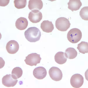 Babesia_thin_giemsa4.jpg