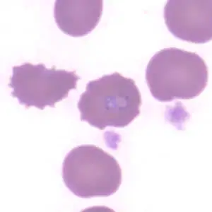 Babesia_thin_giemsa5_AZ.jpg