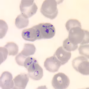Babesia_thin_giemsa_tetrad2.jpg