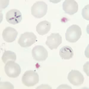 Babesia_thin_giemsa_tetrad3.jpg