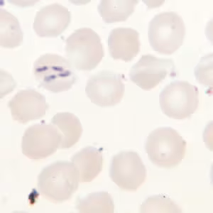 Babesia_thin_giemsa_tetrad4.jpg