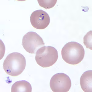 Babesia_thin_giemsa_extracellular2.jpg