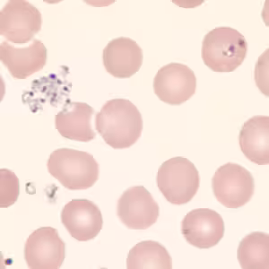 Babesia_thin_giemsa_extracellular3_CT.jpg