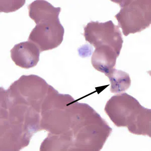 B_MO1_thin_giemsa10_arrows.jpg