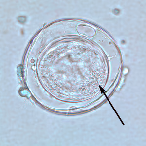Bertiella_egg_BAM_1000x2.jpg