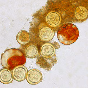 Bertiella_egg_Clinipath_A.jpg