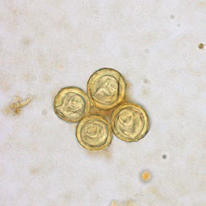Bertiella_egg_Clinipath_B.jpg