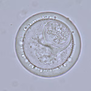 Bertiella_eggs_LTU2.jpg