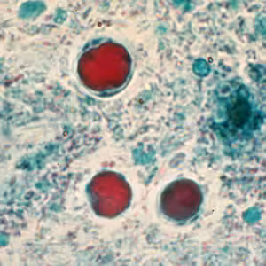 Figure E