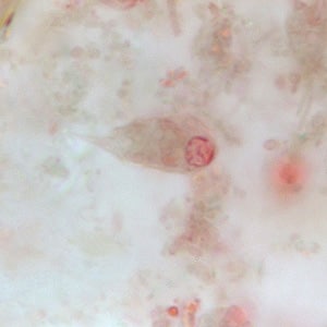 C_mesnili_troph_BM1.jpg