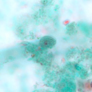 C_mesnili_cyst_trichrome_BM1.jpg