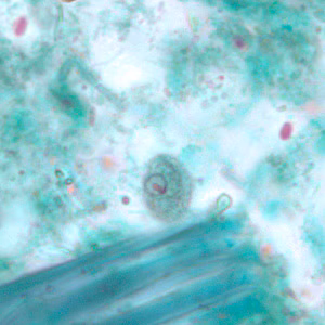 C_mesnili_cyst_trichrome_BM2.jpg