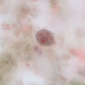 C_mesnili_cyst_trichrome_BM3.jpg