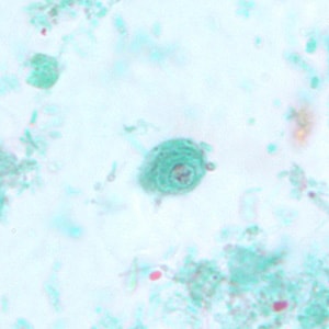 C_mesnili_cyst_trichrome_BM4.jpg
