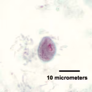 C_mesnili_cyst_trichrome_HB1.jpg