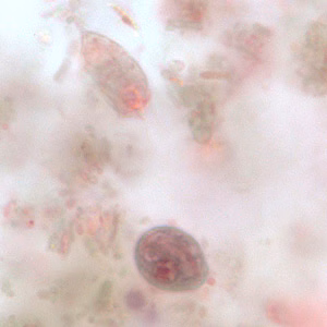 C_mesnili_cyst_troph_BM1.jpg