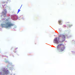Cparvum_trichrome1_BAM.jpg