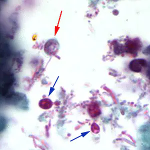 Cparvum_trichrome2_BAM.jpg