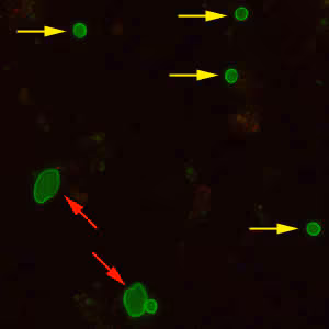 CryptoGiardiaDFA_400x2_arrows.jpg