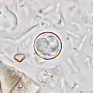 Cyclospora_wetmount_HB1.jpg