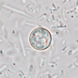 Cyclospora_wetmount_HB2.jpg