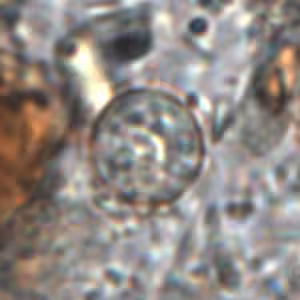 Cyclospora_wtmt2_1000X_OR.jpg