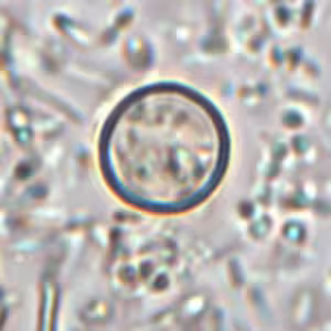 Cyclospora_wtmt_1000X_OR.jpg